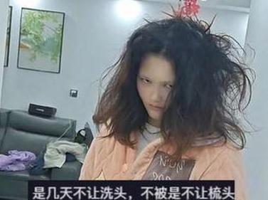 女子产后不洗头 头发变成“稻草”